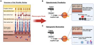 Bridging the gap of vision restoration